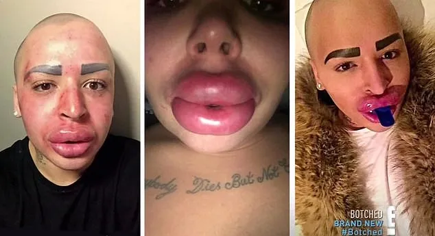 مرگ مشکوک زن شیفته کیم کارداشیان ملقب به «سلطان لب» مرگ مشکوک زن شیفته کیم کارداشیان ملقب به «سلطان لب»