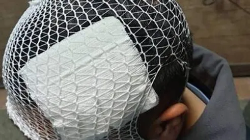 پرتاب لیوان از سوی معلم، یک دانش‌آموز را راهی بیمارستان کرد