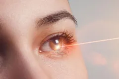 آیا چشم دچار آفتاب‌سوختگی می‌شود؟