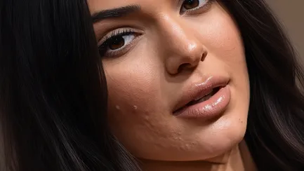 وقتی جوش‌های صورت کندال جنر خبرساز شد؛ راز پشت چهره بی‌نقص سوپرمدل‌ها چیست؟