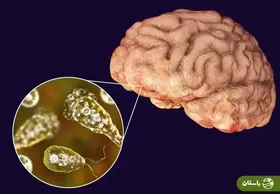 وحشت در هند از بیماری مرموزی که مغز انسان را می‌خورد