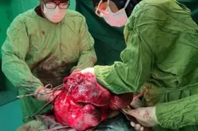 عکس | خروج تومور ۱۱ کیلویی از شکم یک بیمار