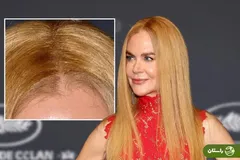 لغزش کلاه گیس نیکول کیدمن در شام جشنواره کن خبرساز شد + عکس