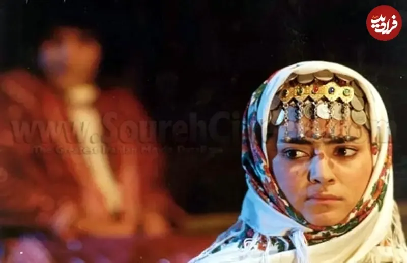 کمند امیرسلیمانی قبل از جراحی بینی