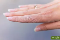 دلیل خشک شدن پوست در پاییز چیست؟