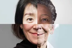 یک‌ شبه پیر شدن حقیقت دارد؟