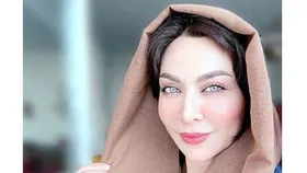 این بازیگر زن کیست؟ از روی عکس کودکی‌اش حدس بزنید