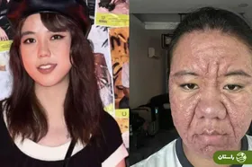 حیرت جهان از تغییرات شدید ظاهری زن ۲۸ ساله در دوران بارداری