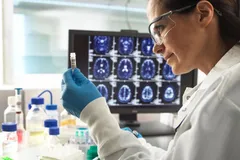 سرنخ‌‌های جدید و عجیب درباره آلزایمر