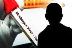 احتمال شیوع جهانی یک ویروس عفونی از طریق رابطه جنسی یا تماس پوستی