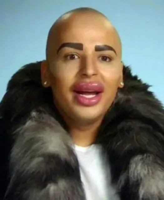 مرگ مشکوک زن شیفته کیم کارداشیان ملقب به «سلطان لب» مرگ مشکوک زن شیفته کیم کارداشیان ملقب به «سلطان لب»