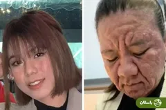 حیرت جهان از تغییرات شدید ظاهری زن ۲۸ ساله در دوران بارداری