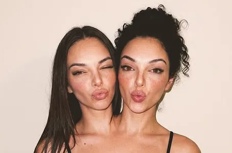 جنجال دوقلو‌های به‌هم‌چسبیده مشهور در اینستاگرام که فیک از آب درآمدند!