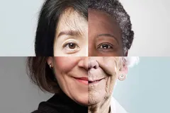 یک‌ شبه پیر شدن حقیقت دارد؟