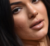 وقتی جوش‌های صورت کندال جنر خبرساز شد؛ راز پشت چهره بی‌نقص سوپرمدل‌ها چیست؟