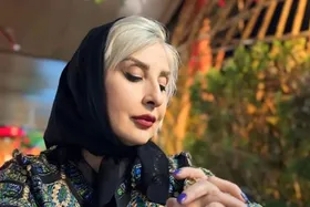 عکسی که عمل زیبایی مرجانه گلچین را لو داد!