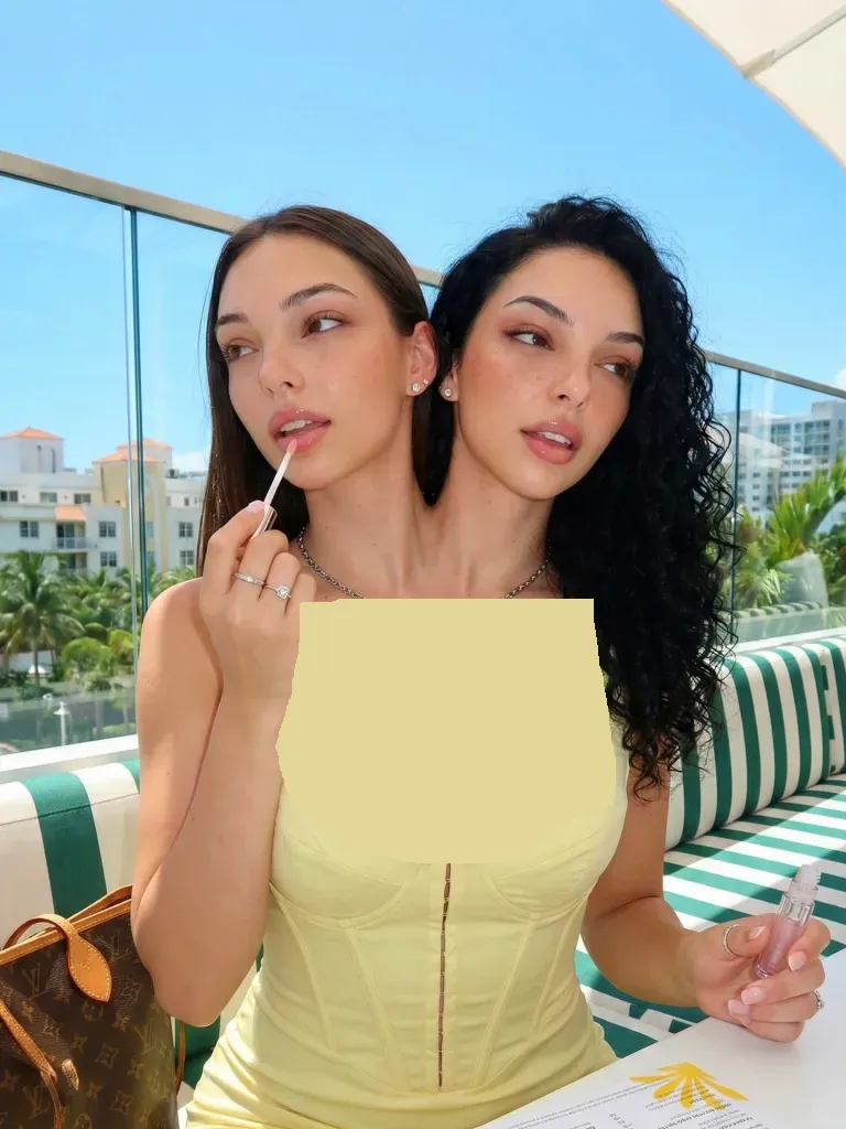 دوقلوهای به هم چسبیده