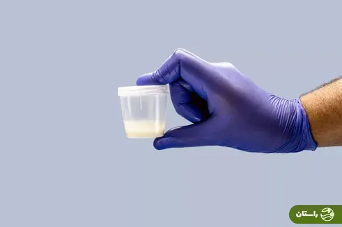 اهداکننده اسپرم حامل ژن سرطانی؛ نزدیک به ۲۰۰ کودک در خطر