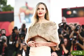 ماجرای رگ‌های بیرون‌زده آنجلینا جولی چیست؟ + عکس