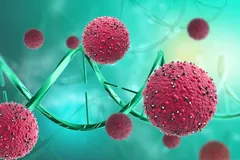 درمان معجزه‌آسای سرطان با یک پمپ