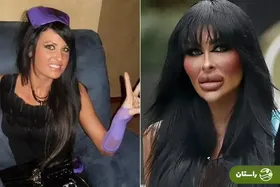 (تصاویر) ظاهر جدید «باربی انسانی»؛ این زن استرالیایی ۲۰۰،۰۰۰ دلار صرف جراحی زیبایی کرده است