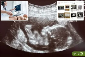 کلاهبرداری از مردان ژاپنی با استفاده از عکس‌های سونوگرافی