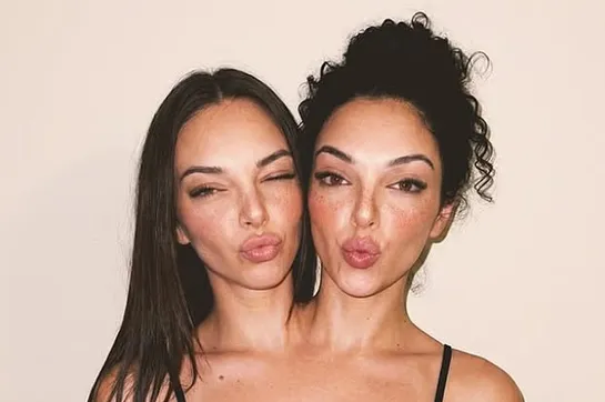 جنجال دوقلو‌های به‌هم‌چسبیده مشهور در اینستاگرام که فیک از آب درآمدند!