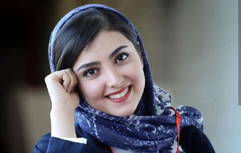 (عکس) زیبا کرمعلی با تیپ سنجابی