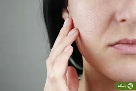 راه‌ و روش‌های ساده بستن منافذ پوست را برای داشتن یک صورت زیبا یاد بگیرید