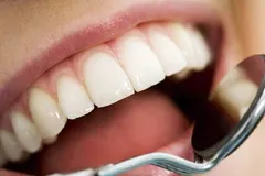 چه بیماری‌هایی را می‌توان از وضیت دهان و دندان تشخیص داد | رابطه قند خون و بوی دهان
