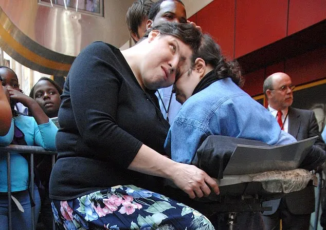 دوقلوهای به هم چسبیده