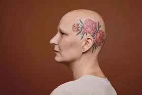 آیا خالکوبی احتمال ابتلا به سرطان بدخیم را افزایش می‌دهد؟