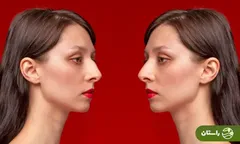 فیلمی از رونمایی از اولین جراحی «بینی قوزدار»  ترند زیبایی سال ۲۰۲۶  در ایران!