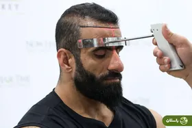 تصاویر | هادی چوپان با چهره جدیدش همه را غافلگیر می‌کند