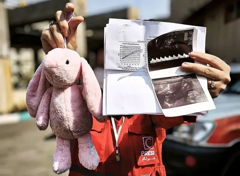 تصویر سونوگرافی یک مادر که زیر آوار ماند