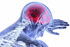 شرایط آب‌و‌هوایی شدید به سلامت مغز آسیب می‌زند