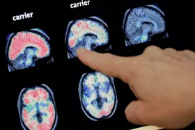 تحقیقات تازه دانشمندان؛ خواب به دفع سموم مغز کمک نمی‌کند