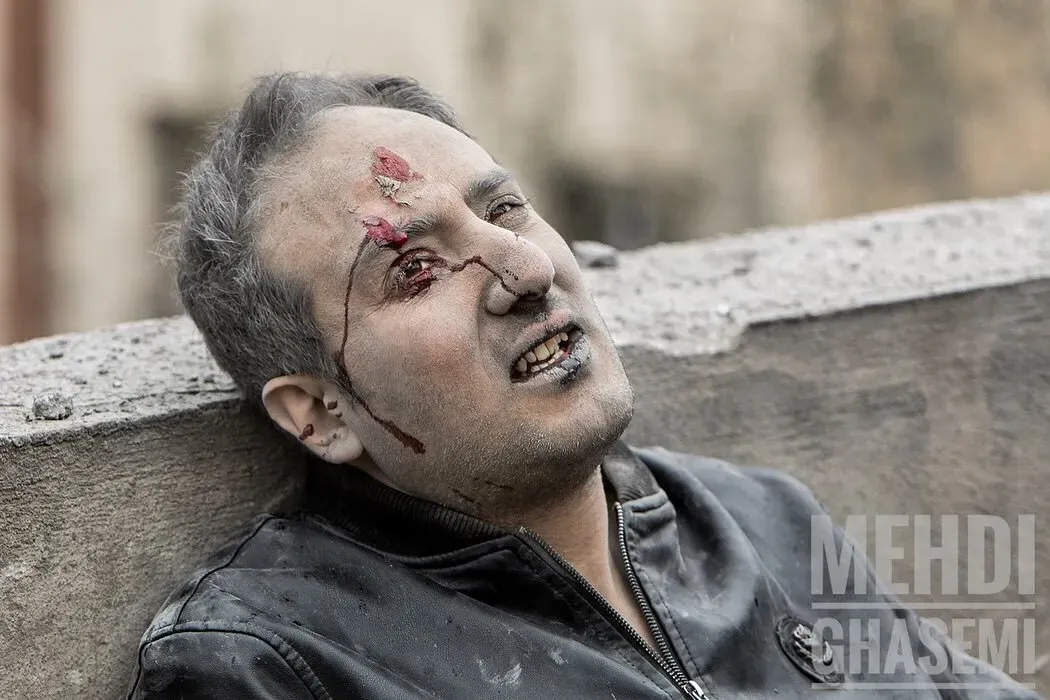 صحنه های تلخ از مردم بی پناه و گرفتار درجنگ