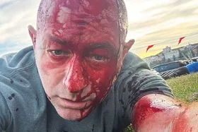 تیراندازی مرگبار در جشن ساحلی یهودیان در استرالیا؛ دستکم ۱۲ نفر کشته شدند + ویدئو