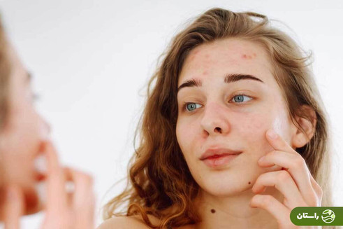 «مثلث مرگ» چیست و چرا فشار دادن جوش روی بینی یا کندن موی بینی می‌تواند ما را به بیمارستان بکشاند؟