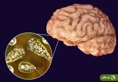 وحشت در هند از بیماری مرموزی که مغز انسان را می‌خورد