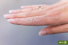 دلیل خشک شدن پوست در پاییز چیست؟