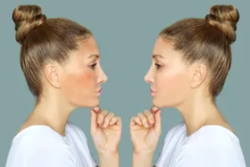 چگونه از لکه‌های تیره پوست خلاص شویم؟