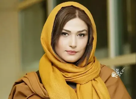 تغییر چهره لادن مستوفی خبرساز شد